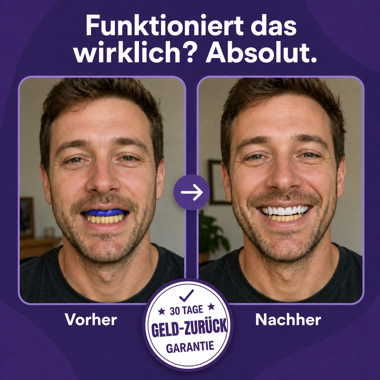 Purple Whitening Strips - 1+1 GRATIS