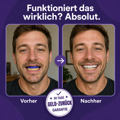 Purple Whitening Strips - 1+1 GRATIS