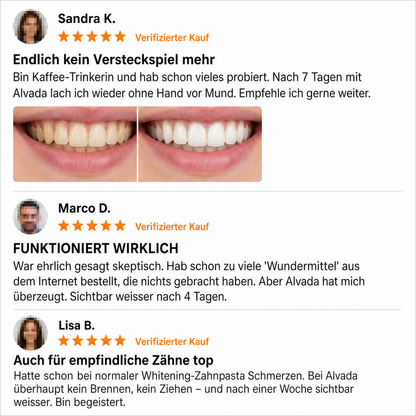 Purple Whitening Strips - 1+1 GRATIS