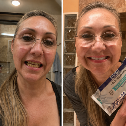 Kokosnuss Whitening Strips