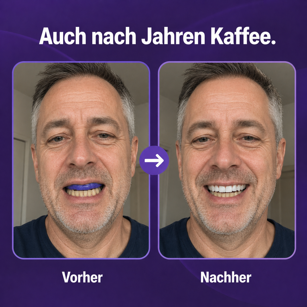 alvada-vorher-nachher-50jahreMann