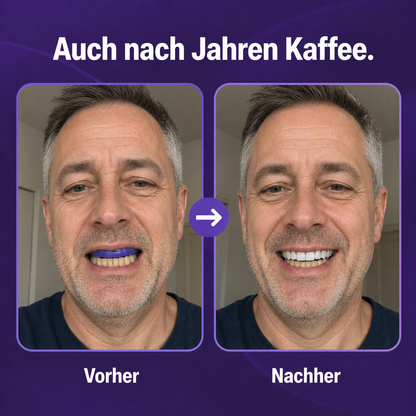 alvada-vorher-nachher-50jahreMann